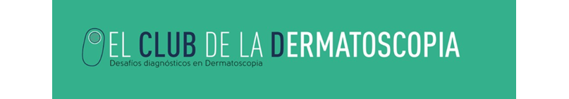 Dermatologia Curso de Dermatoscopia