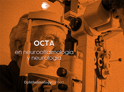 HealthConnect OphthalmologyConnect Oftalmología Videos Salud Angiografía por tomografía de coherencia óptica 