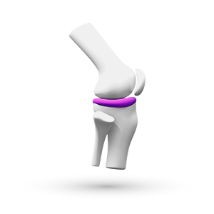 Dolor Lyrica Celebrex Pregabalina Celecoxib Logo